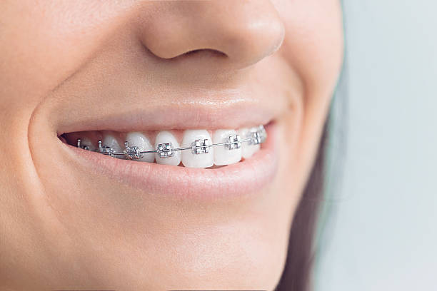 Best Invisalign and Clear Aligners  in The Plains, OH